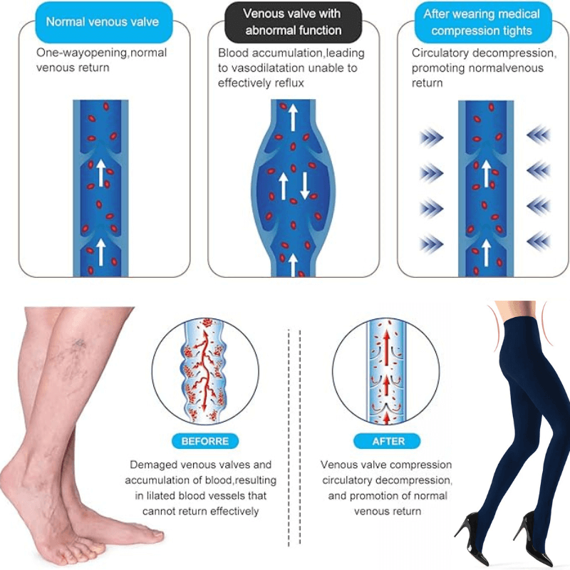 LuxeMotion™ Compression Stockings